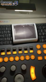 Ultrasound device for medical clinics Medison Sansung